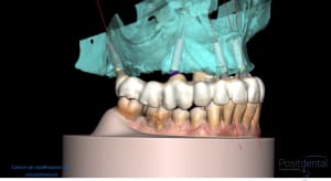 Kq2hg09jwvdptonhxt9b3k77fijp - Eugenol