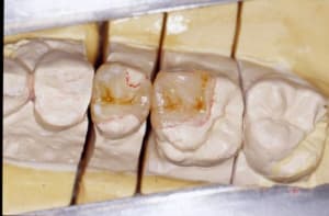 Labo mholtu - Eugenol