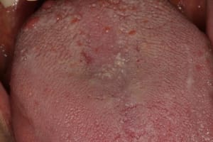 Langue p4glbe - Eugenol
