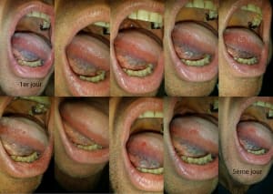 Langue rjw9mi - Eugenol