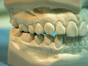 Latgauche2 cspuxi - Eugenol