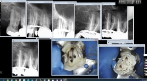Le han t 1 jllp7t - Eugenol