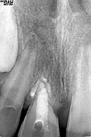 Lee roy mars 07 matzp3 - Eugenol
