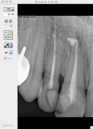 Lentulo 1 nzhnnw - Eugenol