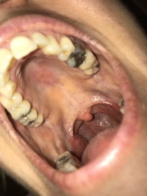 Lgaw3jua9w5gso0qzpxq - Eugenol