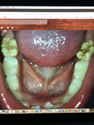 Lk9fyw1jkgdcxxoficg8 - Eugenol