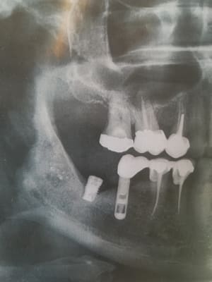 Lobbwnl3ji4amgkqvhx0 - Eugenol