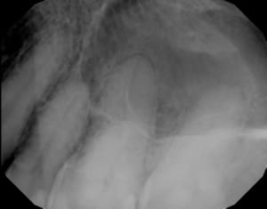 Lpselfrhpzkunyaucbb5 - Eugenol