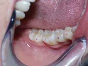 Manddroite ym8td4 - Eugenol