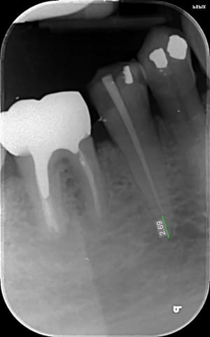 Matu 1 vwkzzx - Eugenol