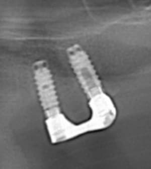 Mn2a9pynaan4wr7mgo7v - Eugenol