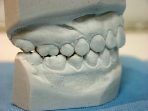 Modéle2 jevge7 - Eugenol