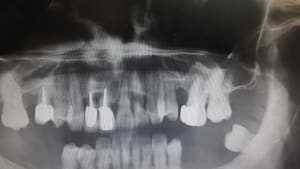 Ms3gkrzyqbpq3bkaithj - Eugenol