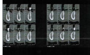 Numeriser sxk2cr - Eugenol