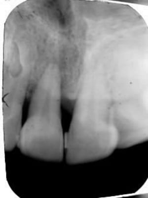 Oct2012 rjs1uj - Eugenol