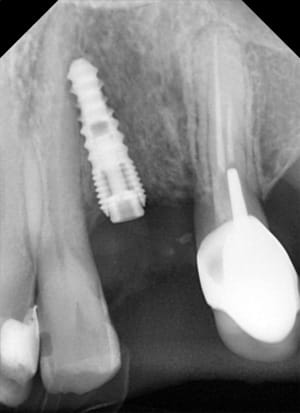 On parle on parle et on fore à coté vwudtj - Eugenol