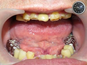 Ooxlhjeyfh5hqk6jolywiv7nm7wr - Eugenol