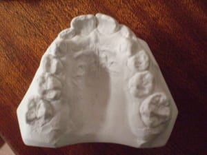 Ortho04 o92knh - Eugenol