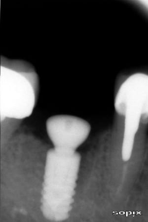 Osdecembre2009 mftbab - Eugenol