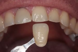 P teinte ugowf9 - Eugenol