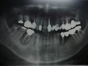 Pano0905 j8u5ih - Eugenol