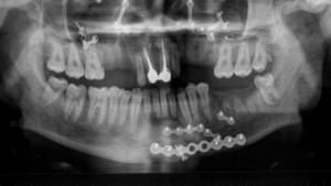 Pano2 lztpwe - Eugenol