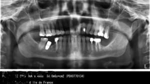 Pano 1 wqes2b - Eugenol