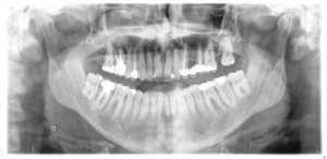 Pano annie1 drczop - Eugenol