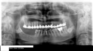 Panoramique2 ltnig2 - Eugenol