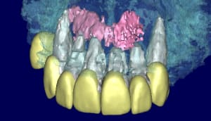 Patricia 3d2 qofhzt - Eugenol