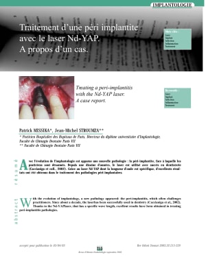 Peri implantite dxd4qe - Eugenol