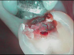 Pfff bafvp8 - Eugenol