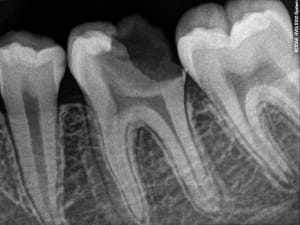 Pfyxurgx6doyj0jhparu - Eugenol
