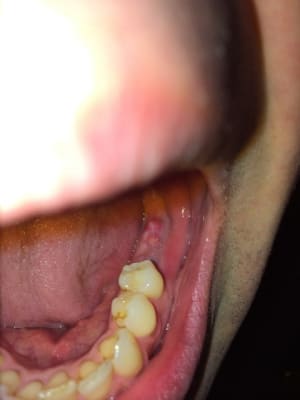 Photo 2 oecod5 - Eugenol