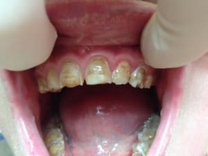 Photo 2bis bcor0o - Eugenol