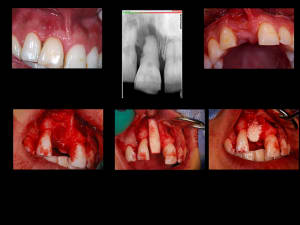 Planche1 king6b - Eugenol
