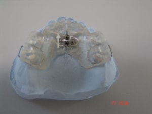 Plaque isaie 1 sbvvh7 - Eugenol