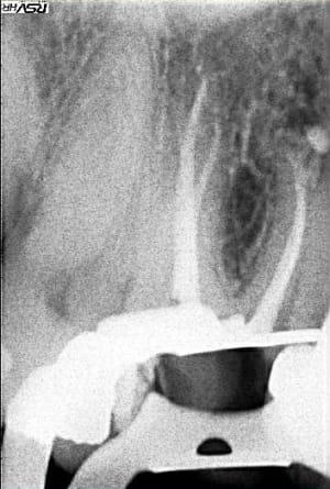 Postop16 oetolv - Eugenol