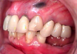 Prf3 ghkzmt - Eugenol