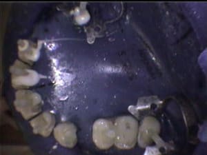 Pria3 - Eugenol