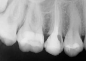 Qg5svu4fnsvjubquojt9 - Eugenol