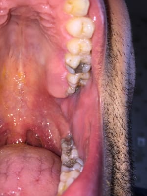 Qwqramv6utnoqjqbfxbr - Eugenol