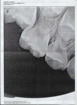 Radio eugenol vsxcen - Eugenol