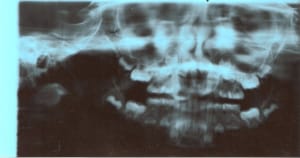 Radio pano lat3bi - Eugenol