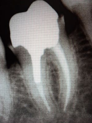 Radiocontroleic w8walk - Eugenol
