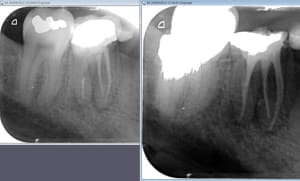 Reprise q1xgmd - Eugenol