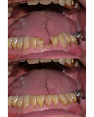 Retouche photo1 z5fzv6 - Eugenol