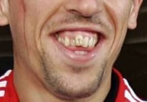 Ribery2 xymqf0 - Eugenol