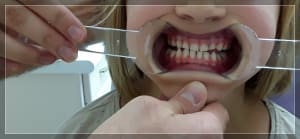 Runuuym5dznymys2dpdtckogukj2 - Eugenol