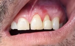 S827xi977r7h80j64a6bwns3lrk1 - Eugenol